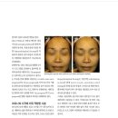 청담아티젠의원