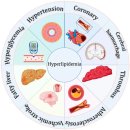 창원 Ace치과기공소 | 고혈압·고지혈증 환자를 위한 안심 임플란트 | 천안 두정서울비디치과