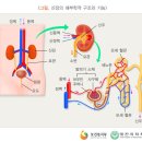 신장염(사구체 신염) 이미지