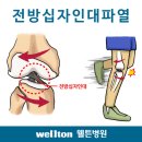 관절내시경//반월상연골판 파열//전후방 십자인대 파열//관절내시경수술 잘하는 병원//무릎연골수술 이미지