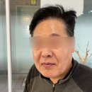 부평피부관리 더맑은스킨 남자 피부관리 후기