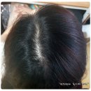 셀리턴 알파레이로 두피관리 1개월 후기
