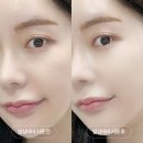 비비드림 | 시바산 비비 2종 비교후기│발삼비비/메소비비 선택법 알려드림