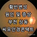 씨유안경콘택트 | 전 세계 실명원인 8.7% 황반변성 부천상동 씨유안경콘택트 원인 및 증상 확인해보기