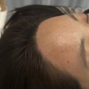 가음정로-2 | 창원헤어라인왁싱 은아하다 영현원장님