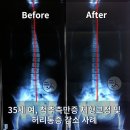 리얼리햅 맞춤운동센터 | 리얼리햅 맞춤운동센터: 측만증 전문 교정센터!