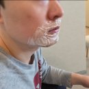 [용산 남자 수염 제모 병원] &#39;밴스의원&#39; 젠틀맥스 프로 플러스 제모 내돈내산 후기