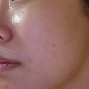 아르케스파 홍대점 | 트로이아르케 에스테틱 아르케스파 홍대 내돈내산 4-5회차 관리후기