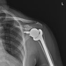 올바른서울병원 이미지