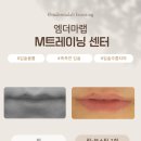 탱글 뷰티 네이버블로그