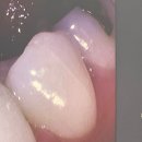 연세라온치과의원 이미지