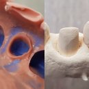 민치과기공소 | 3월 [템포게이트] 임시치아 세미나공지✅️ 조금 부족하다 느낀다면 들어오세요