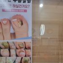 루덴네일