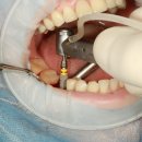 강남애프터치과의원 이미지