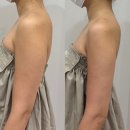 유니에스테틱 | 연산동피부관리 유니유에스테틱 부산팔뚝관리 후기