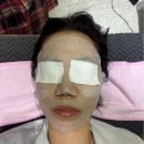 하이푸리프팅 예비신부 포항 피부관리 V얼굴라인 만들기