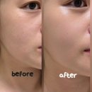 안수 | 에네스티수안수 수안보 기초세트 후기, 온천수화장품 + 화이트닝앰플 피부톤 변화