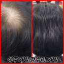 성주가발 여자정수리가발, 자연스러운 착용감과 매력적인 맞춤가발 제목없음