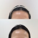 헤어보브 | 청주 헤어라인 성안길 보브로우 넓은 엠자이마 커버 후기