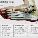 발바닥 통증 있을때 원인 발앞쪽 발뒤꿈치 발끝 발중앙 아킬레스건 이미지