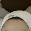 호평동 피부관리 리본테라피 아쿠아필 내돈내산
