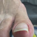 광주오치동우체국 | 광주북구 오치동 내성발톱 안아프게 잘펴주는 루씨드네일샵 페디크루 광주북구점