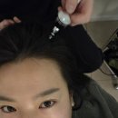 화메디 | 부산두피케어 후기 | 피지 각질 싹! 더노블메디센터 두피관리로 산뜻하게