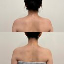 손앤심 | 포항ㅣ승모근 라인&라운드숄더 집중관리가 필요할 때는 "손앤심" 드레스핏 !
