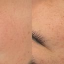 에그뮤즈 스킨스칼프 이미지