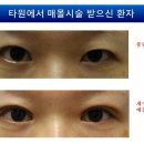 부분밖의 부분 이미지