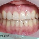 박진우치과의원 네이버블로그