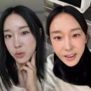 발음 | 이지혜 인중축소술 전후 비교! 동안 얼굴·앞니·발음 솔직 후기