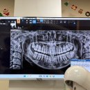 연산치과의원 | 부산 사랑니 안 아프게 뽑는 치과 사랑니랑 구강악안면외과 치과