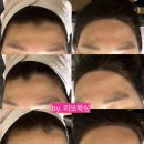 조헤어라인 이미지