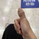 21세기약국 | 일산 손 베였을때 지혈&amp;응급처치 가위 손가락 베임 치료 드레싱 21세기 병원 후기