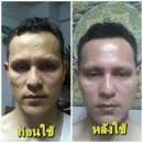 몽니스#