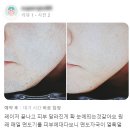 대구남자제모, 맑은결 피부과 후기를 먼저 확인하세요!