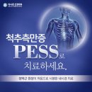 허리협착증명의 정택근원장의 PESS란?
