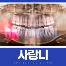 휘치과의원 네이버블로그
