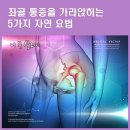 ◑ 좌골 통증을 가라앉히는 5가지 자연 요법 ◑ 이미지