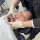 틀치과기공소 | 대구 닥터손치과 직접 체험한 치아미백 후기 1주차