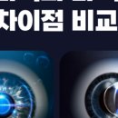 제니스안과의원 네이버블로그