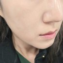 부여세라 | 주사피부염 모낭염 얼굴간지러움 고민 피부 추천 지루샵 세라케어 울트라세럼