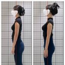 보타닉필라테스 | [공지] 보타닉 필라테스 교정 후기 / 전방경사 후방경사란 [별내발레핏][별내개인레슨][별내필라테스...