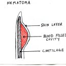 [개&amp;프렌치불독 질병] 이개혈종 ( Hematoma of the Ear Flap ) 이미지