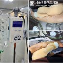 영주치과기공소 | 청량리 치과 추천 유독 까만 앞니 변색, 원인은? - 신경 치료 및 임플란트 식립으로 해결한 이야기