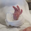 충주별산부인과의원 | [일상] 충주 별 산부인과 제왕절개 출산 후기