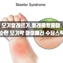 산림약국 | 어린이 저자극 모기약 벌레물렸을 때 아이베러 수딩스틱으로 알레르기 해결