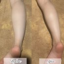 테라피 - 93171 | 강남 에스테틱 추천 청담 신부관리 뷰티블르바드 스톤테라피 솔직후기