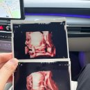 GS25 빛고을병원점 | 빛고을여성병원 21-25주차, 정밀초음파, 임당검사후기